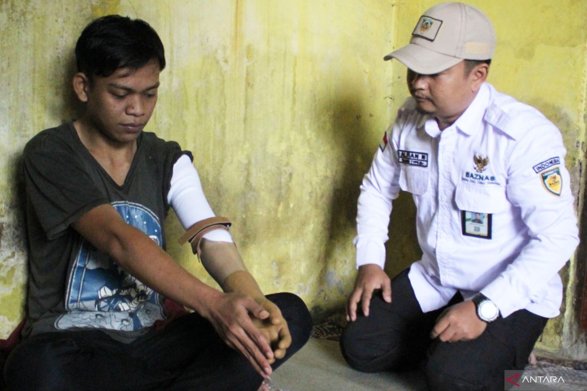 Baznas berikan lengan prostetik untuk penyandang disabilitas di Bogor