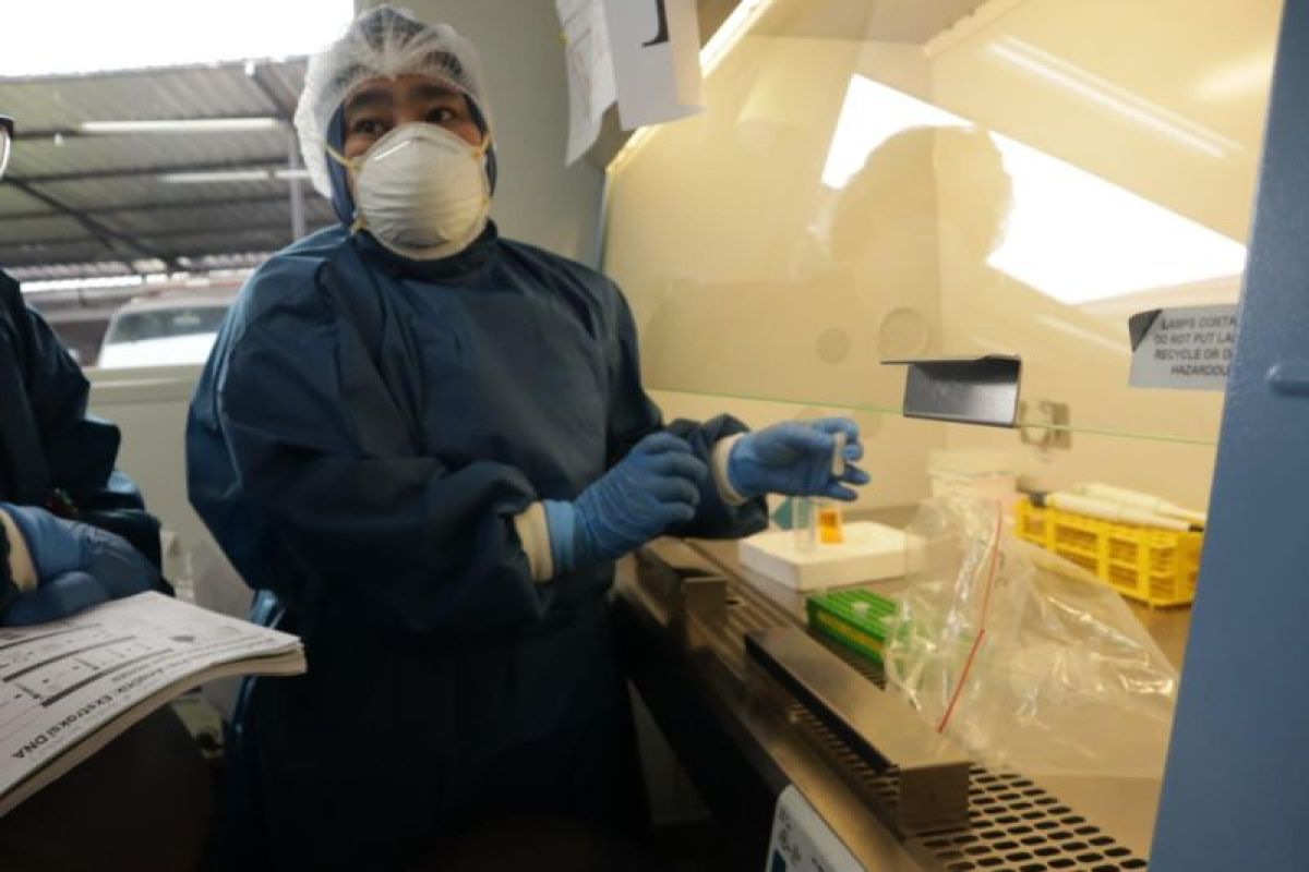 Kalbe dukung penguatan laboratorium nasional untuk eliminasi TB