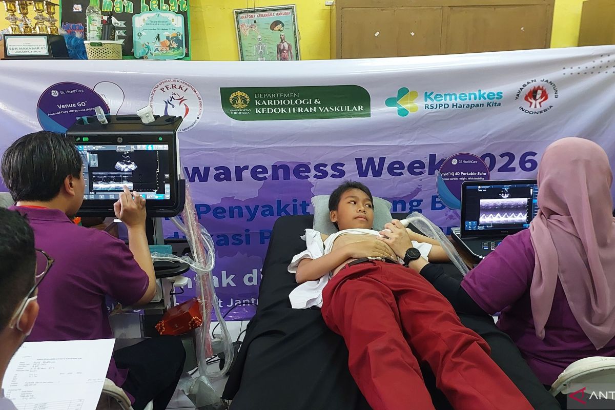 Program skrining siswa SD tingkatkan cakupan deteksi dini PJB