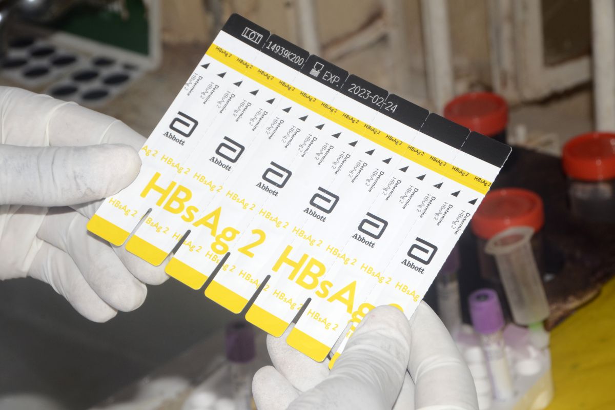 Tes tusuk jari akan perluas akses diagnosis hepatitis B