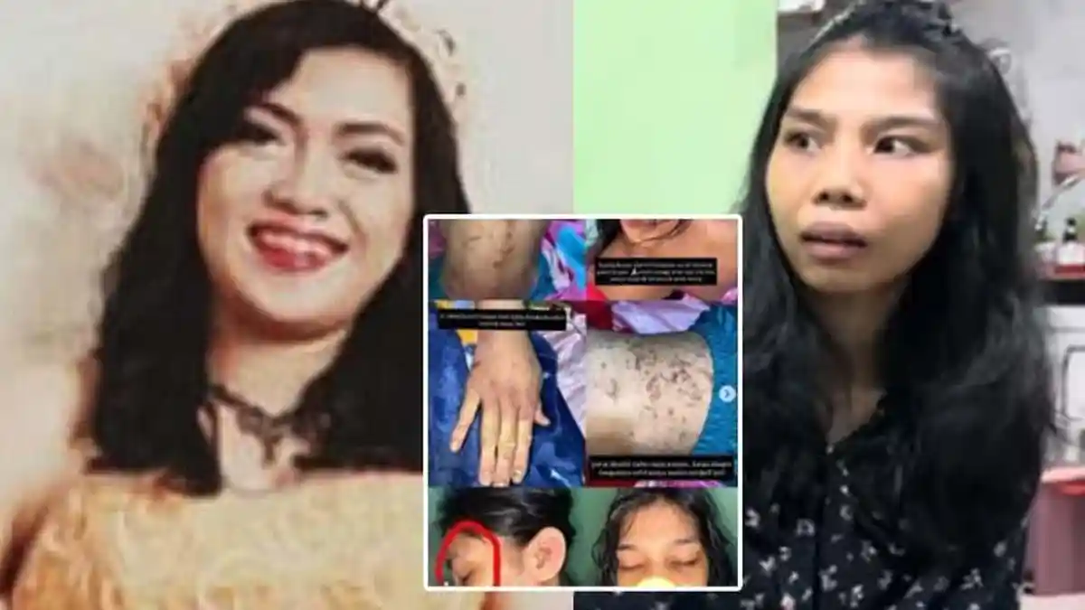 Ternyata ASN BPK di Bogor Tak Cuma Aniaya ART, Suaminya Juga Pernah Disiksa Sampai Bikin Warga Syok